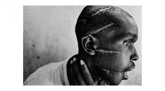 Harry Benson eröffnet IPFO