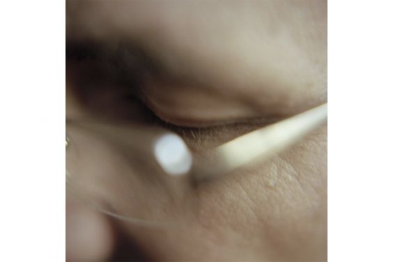 Und dann war alles blau